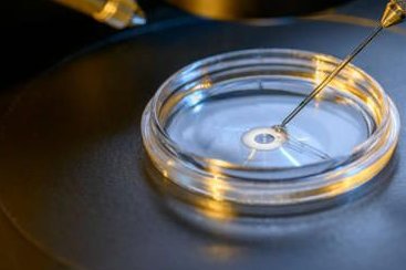 试管婴儿促排卵针是打哪里？