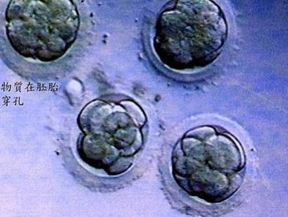 成都试管婴儿分娩成功率可观吗？